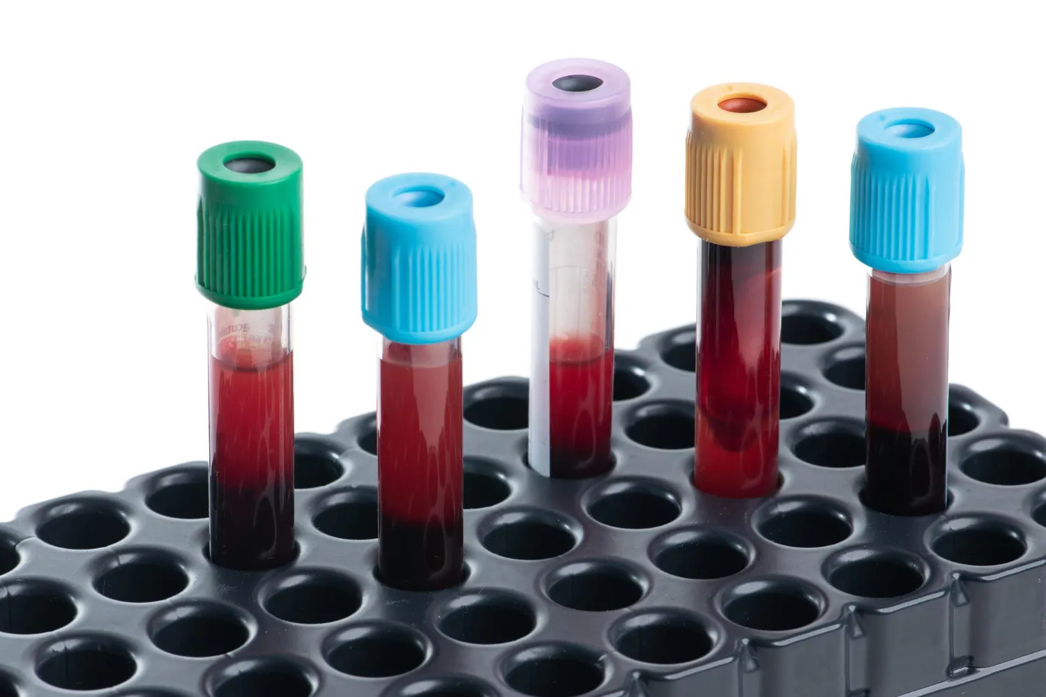 tubos de laboratorio clínico para uso en laboratorio clinico en barranquilla y colombia