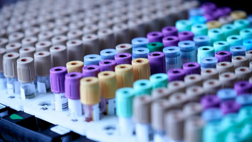 Gradilla con tubos de muestras de colores en el laboratorio clínico