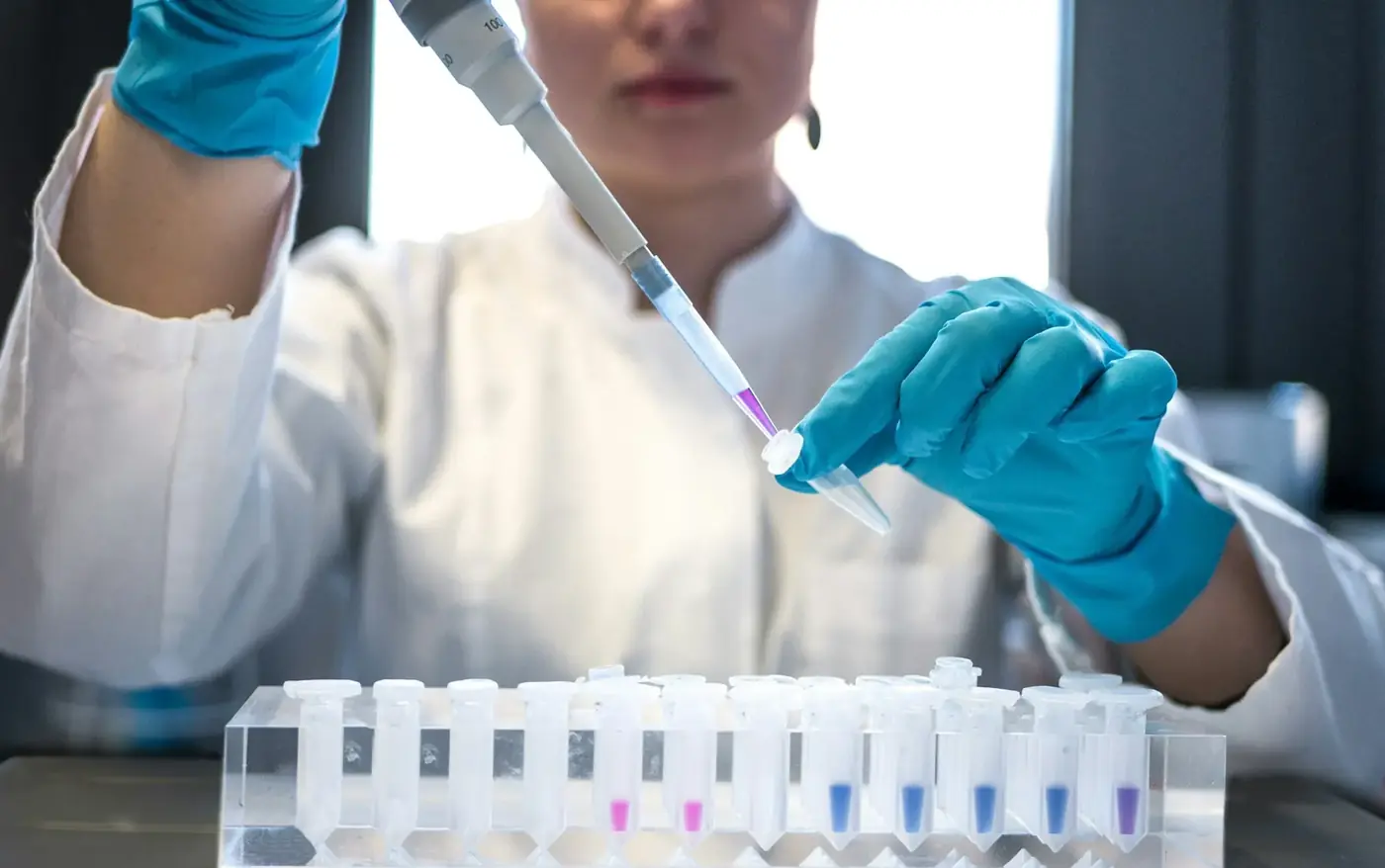 Profesional de laboratorio dispensando muestras con una micropipeta