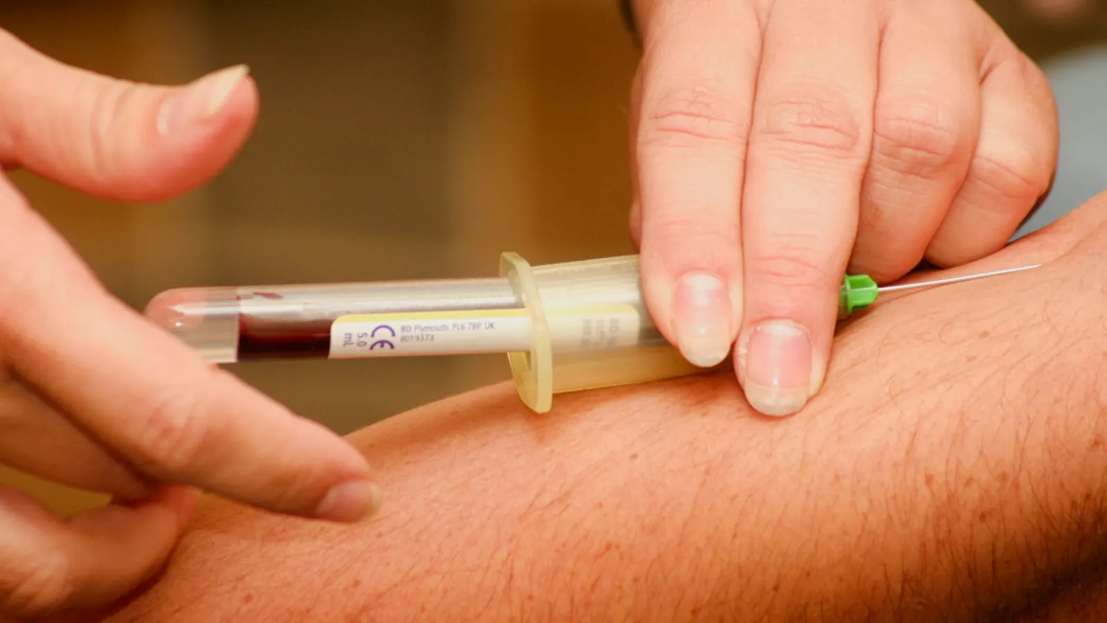Consejos Útiles en la Toma de Muestra de Paciente